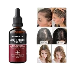 Uptown LA Anti Hair Loss Hair Regrowth Oil 30 ml